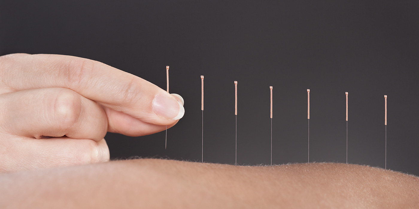 Acupuncture Job Details Cruise Liner London Wellness Academy